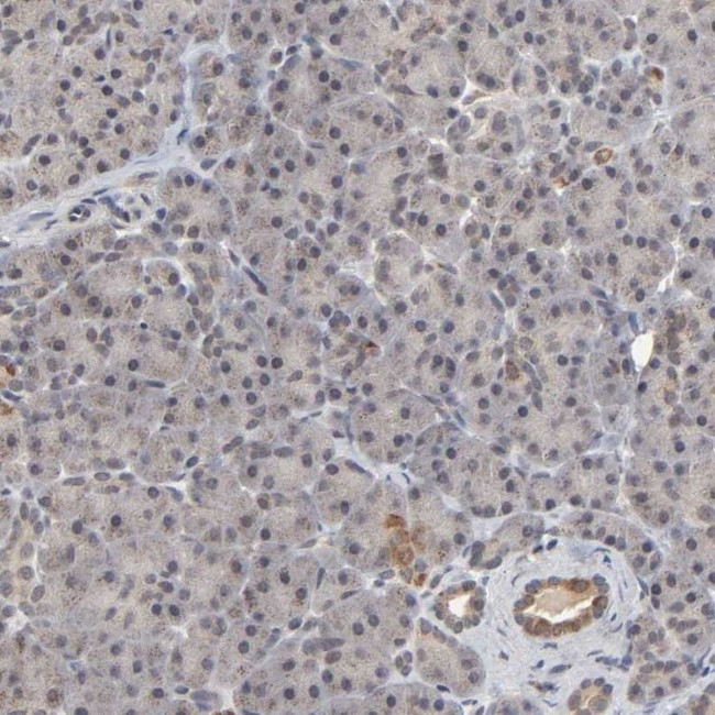 AUH Antibody in Immunohistochemistry (IHC)