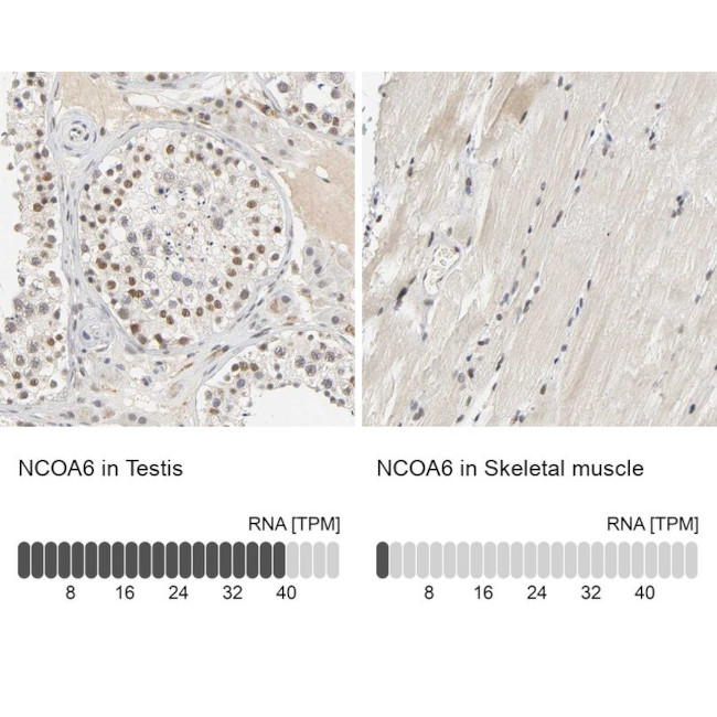 NCOA6 Antibody in Immunohistochemistry (IHC)