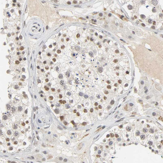 NCOA6 Antibody in Immunohistochemistry (IHC)