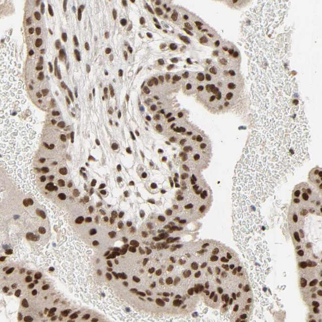 NCOA6 Antibody in Immunohistochemistry (IHC)