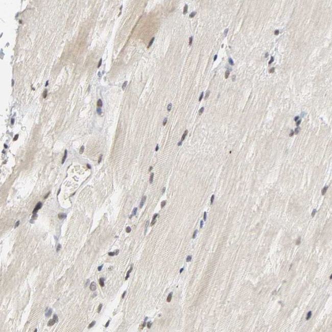 NCOA6 Antibody in Immunohistochemistry (IHC)