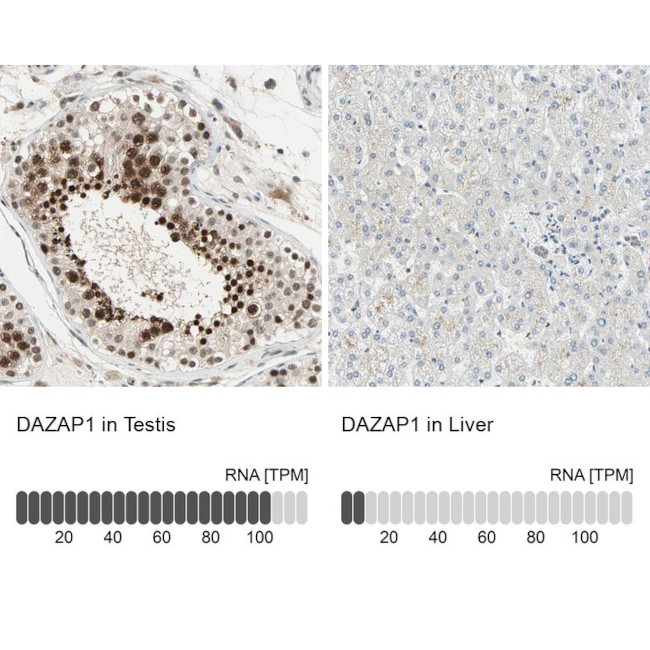DAZAP1 Antibody in Immunohistochemistry (IHC)