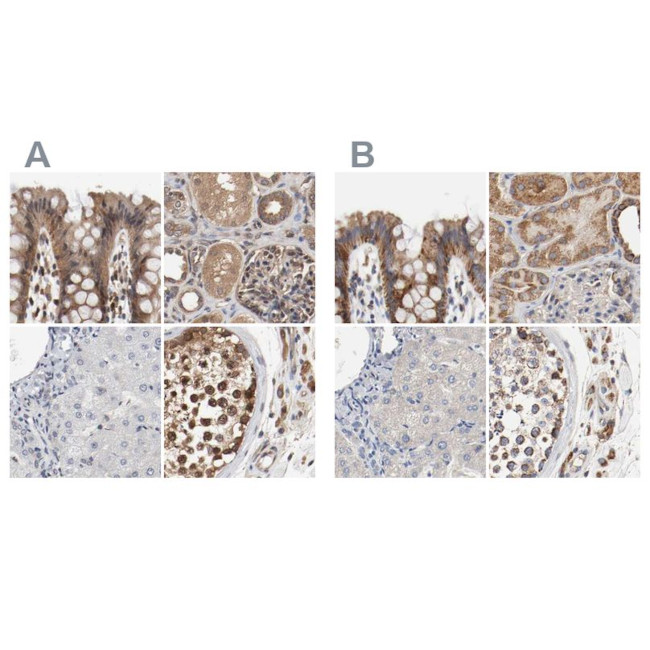 AFG3L2 Antibody in Immunohistochemistry (IHC)