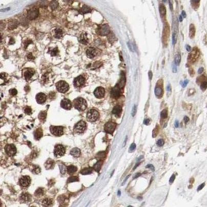 AFG3L2 Antibody in Immunohistochemistry (IHC)