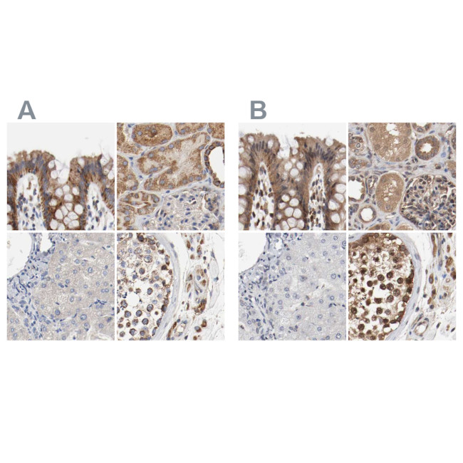 AFG3L2 Antibody in Immunohistochemistry (IHC)