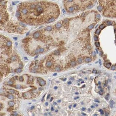 AFG3L2 Antibody in Immunohistochemistry (IHC)