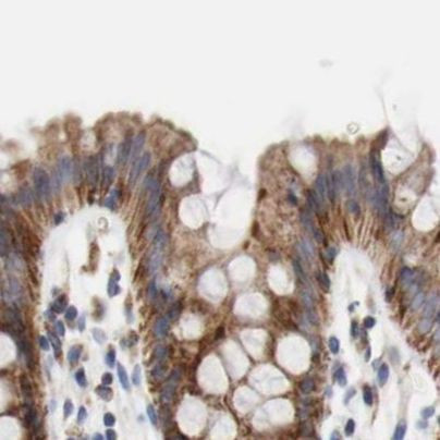 AFG3L2 Antibody in Immunohistochemistry (IHC)