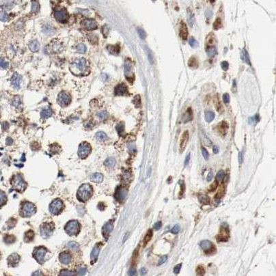 AFG3L2 Antibody in Immunohistochemistry (IHC)