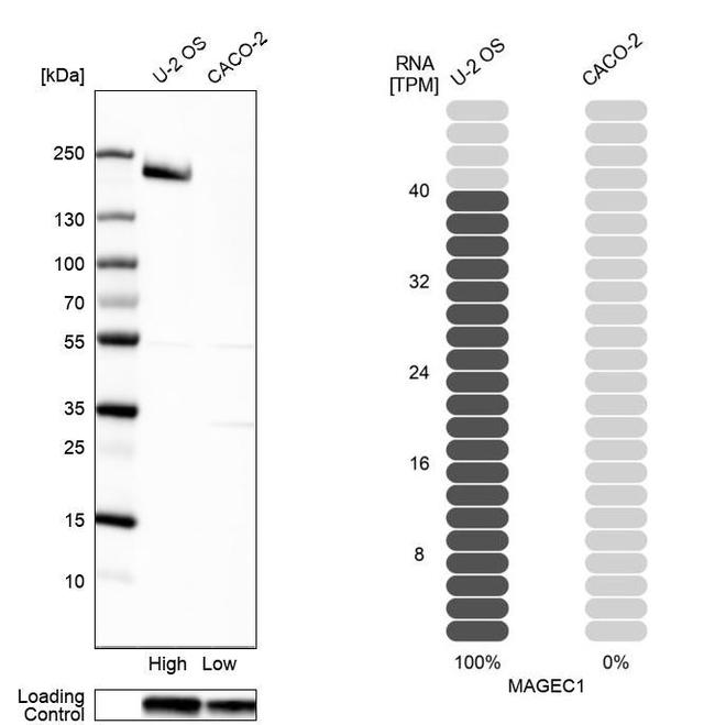 MAGEC1 Antibody in Western Blot (WB)