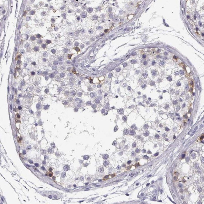 MAGEC1 Antibody in Immunohistochemistry (IHC)