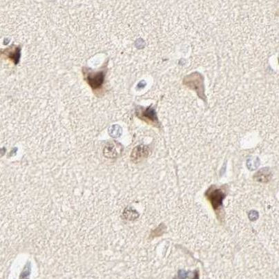 DAZAP1 Antibody in Immunohistochemistry (IHC)