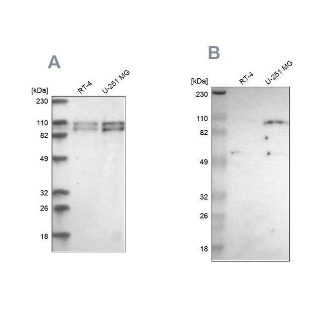 STRN3 Antibody in Western Blot (WB)