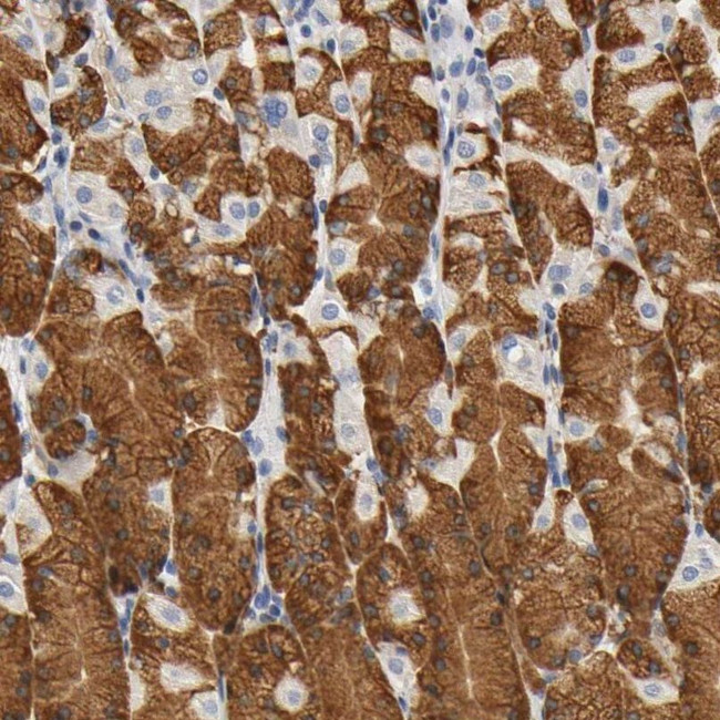 UCKL1 Antibody in Immunohistochemistry (IHC)