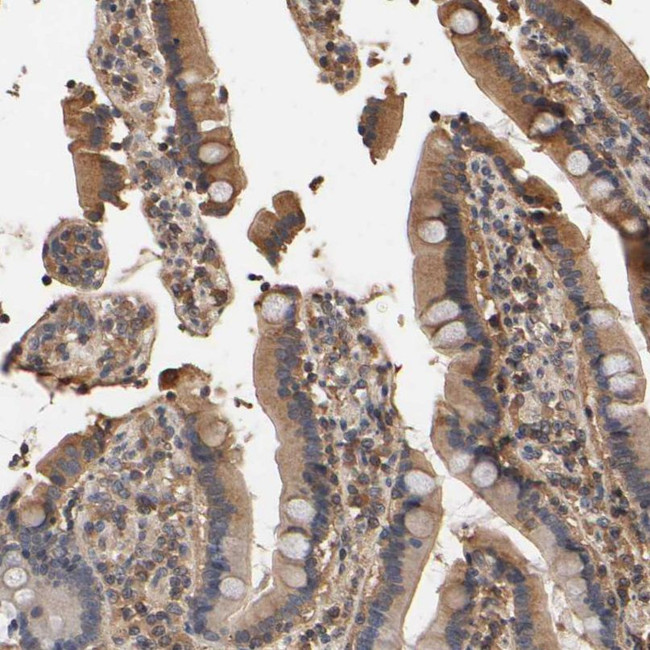 ARHGEF7 Antibody in Immunohistochemistry (IHC)