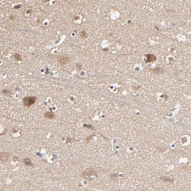 ARHGEF7 Antibody in Immunohistochemistry (IHC)