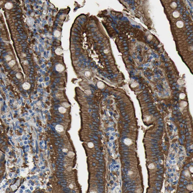 Filamin B Antibody in Immunohistochemistry (IHC)