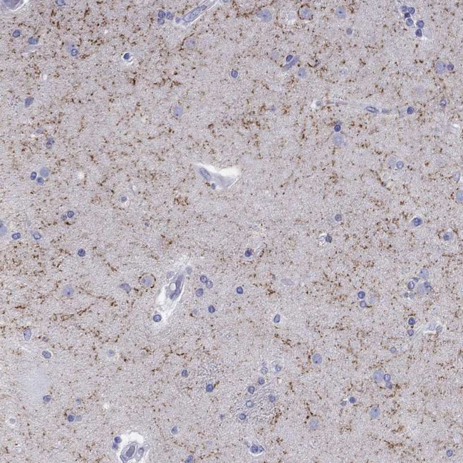 LAMP5 Antibody in Immunohistochemistry (IHC)