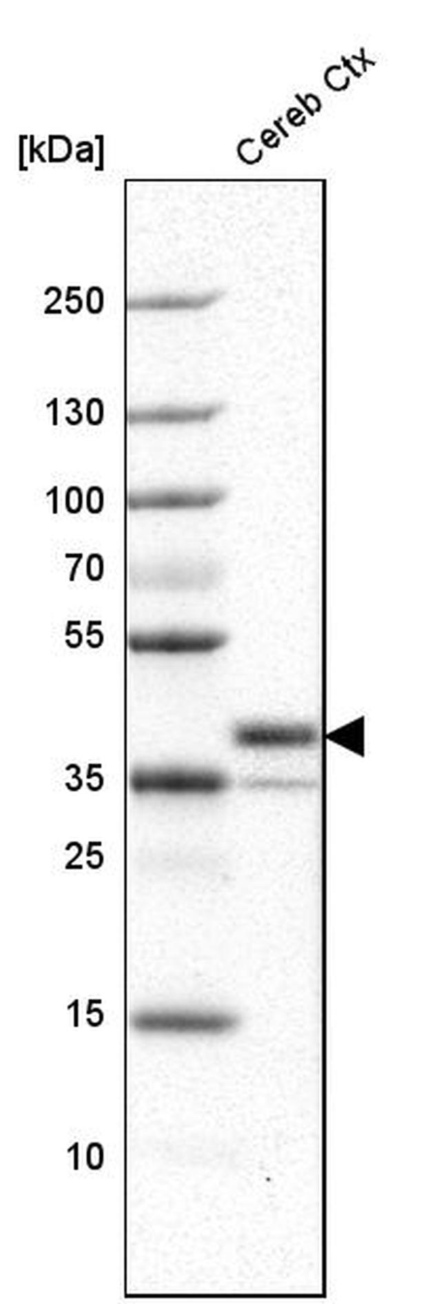 LAMP5 Antibody in Western Blot (WB)