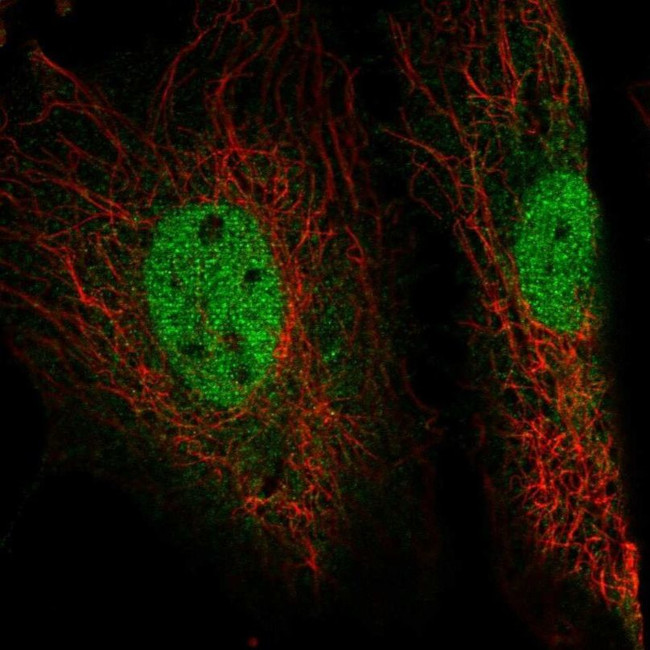 EYA4 Antibody in Immunocytochemistry (ICC/IF)