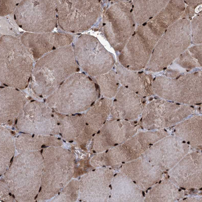 EYA4 Antibody in Immunohistochemistry (IHC)