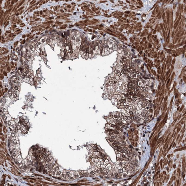 EYA4 Antibody in Immunohistochemistry (IHC)