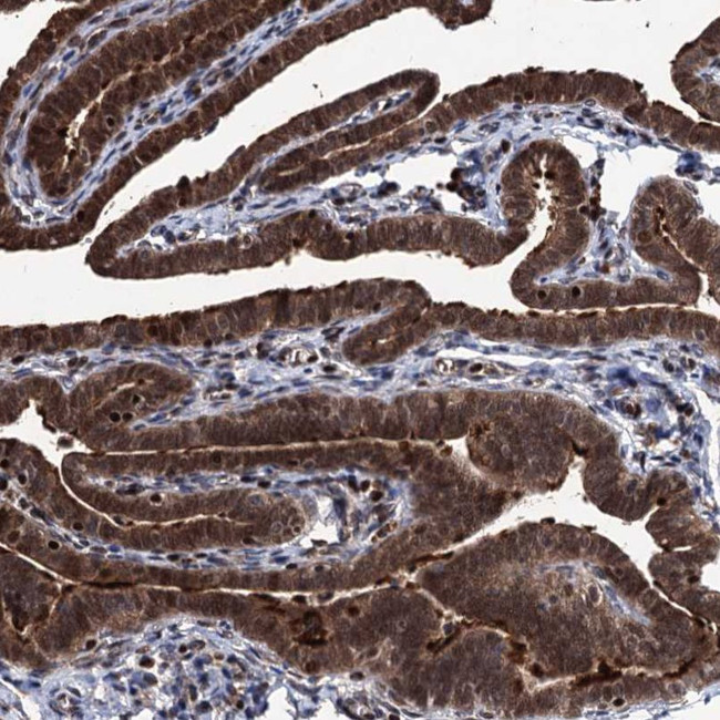 EYA4 Antibody in Immunohistochemistry (IHC)