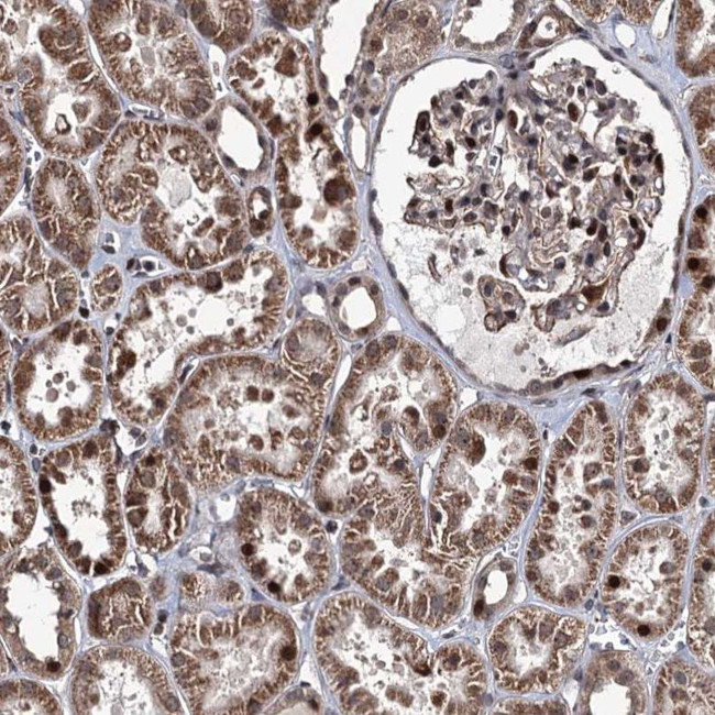 EYA4 Antibody in Immunohistochemistry (IHC)