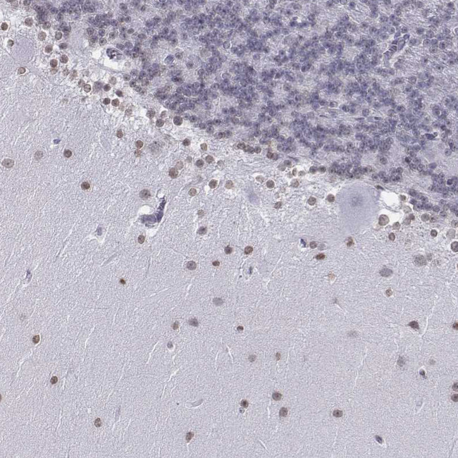 BARHL1 Antibody in Immunohistochemistry (IHC)