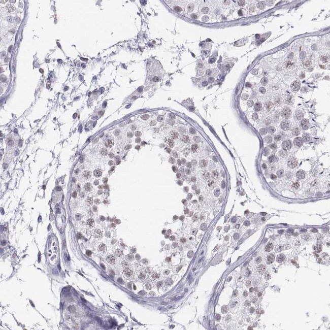 BARHL1 Antibody in Immunohistochemistry (IHC)