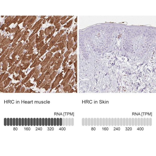 HRC Antibody in Immunohistochemistry (IHC)