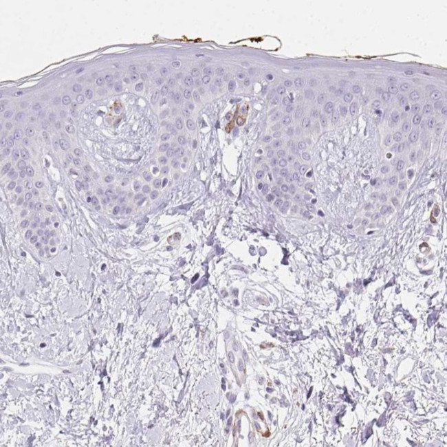 HRC Antibody in Immunohistochemistry (IHC)