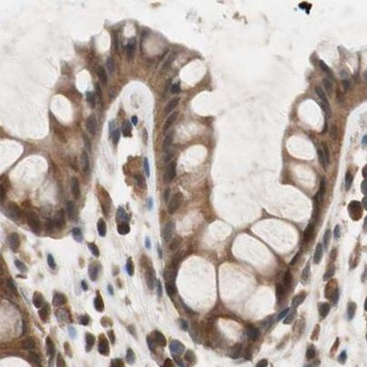 GALT Antibody in Immunohistochemistry (IHC)