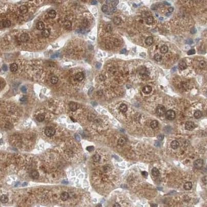 GALT Antibody in Immunohistochemistry (IHC)