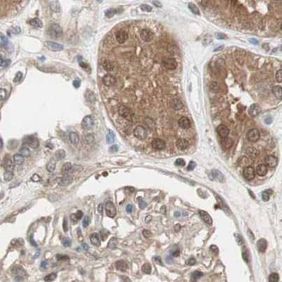 GALT Antibody in Immunohistochemistry (IHC)