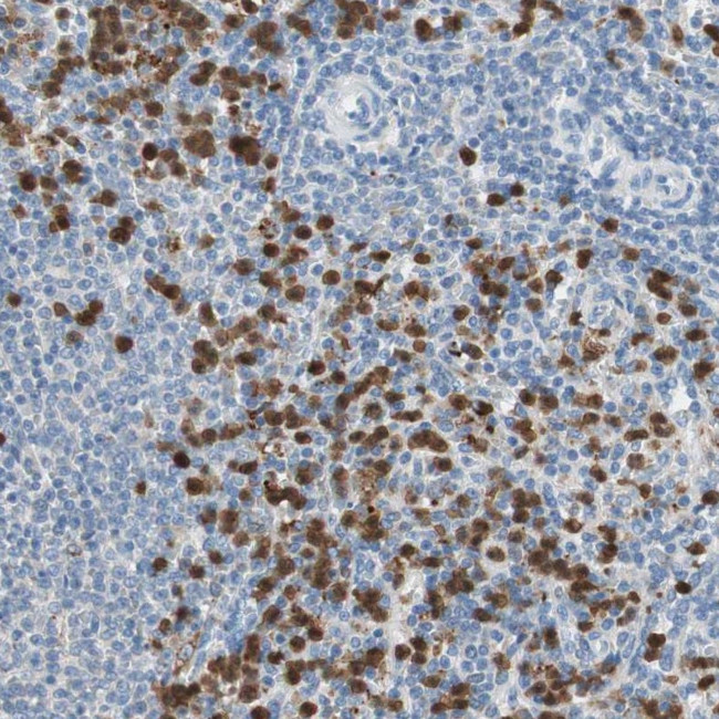 CLEC4D Antibody in Immunohistochemistry (IHC)