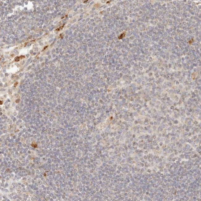 PTPN22 Antibody in Immunohistochemistry (IHC)