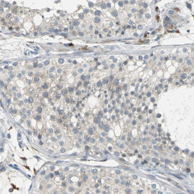 PTGDS Antibody in Immunohistochemistry (IHC)