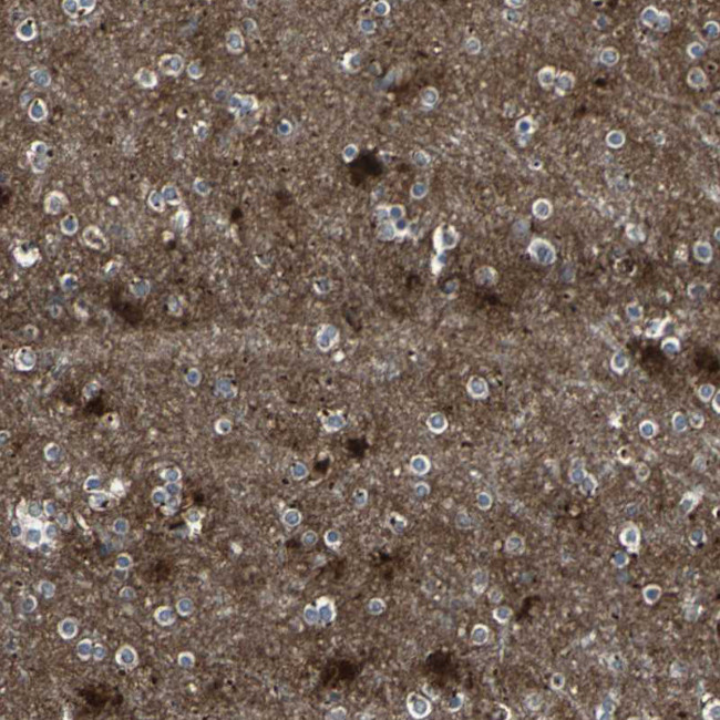 PTGDS Antibody in Immunohistochemistry (IHC)