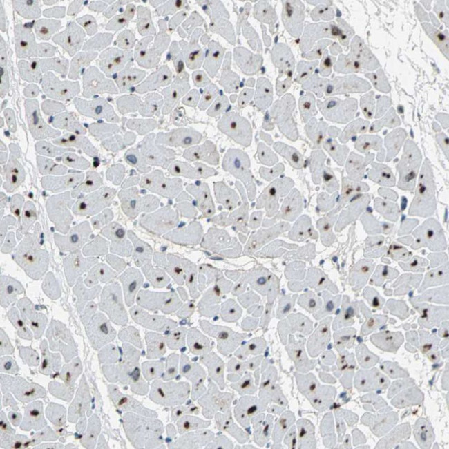 PTGDS Antibody in Immunohistochemistry (IHC)