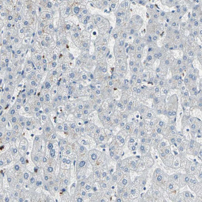 PTGDS Antibody in Immunohistochemistry (IHC)