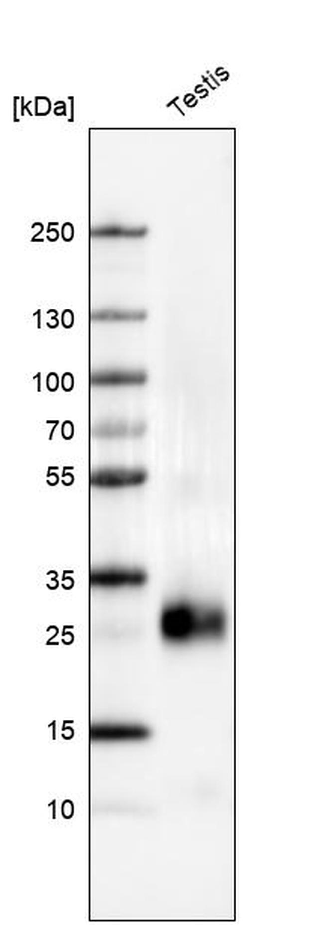 PTGDS Antibody in Western Blot (WB)