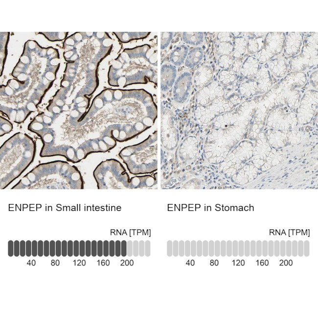 CD249 Antibody in Immunohistochemistry (IHC)