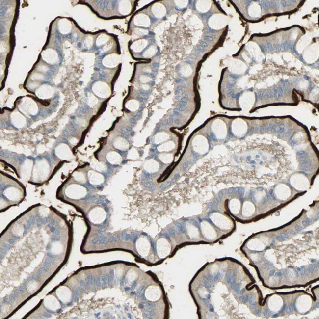 CD249 Antibody in Immunohistochemistry (IHC)