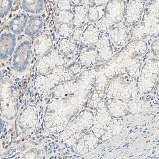 CD249 Antibody in Immunohistochemistry (IHC)