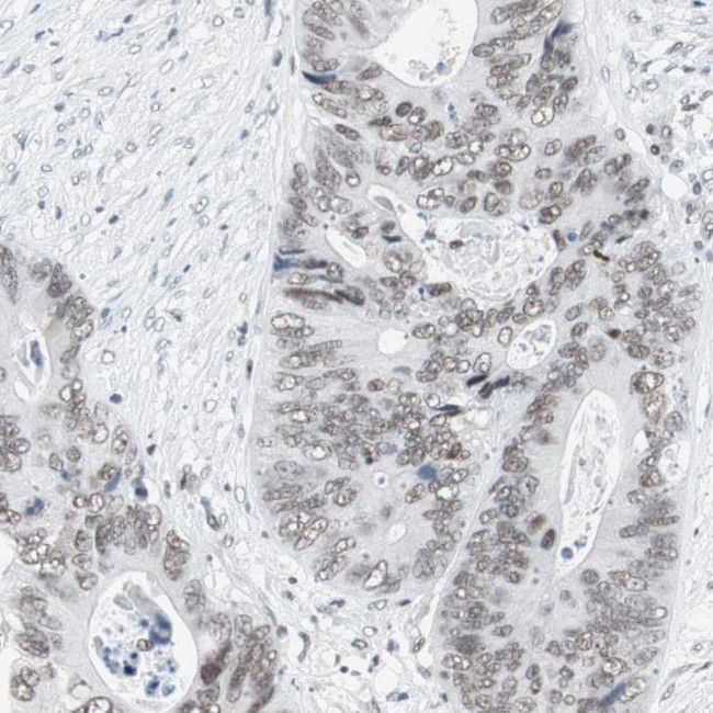 ARID1A Antibody in Immunohistochemistry (IHC)