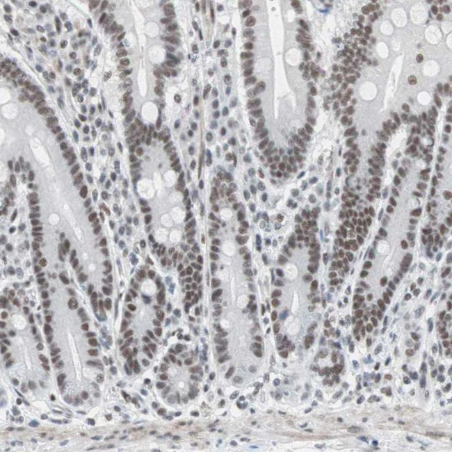 ARID1A Antibody in Immunohistochemistry (IHC)