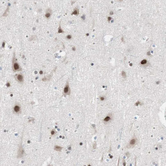 ARID1A Antibody in Immunohistochemistry (IHC)