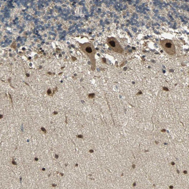 PSMC4 Antibody in Immunohistochemistry (IHC)