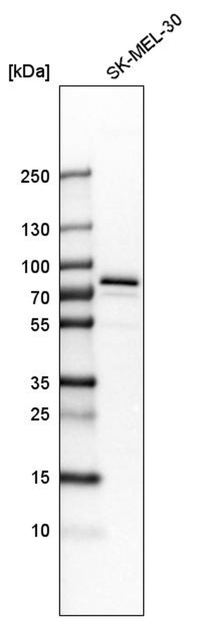 GYG2 Antibody in Western Blot (WB)