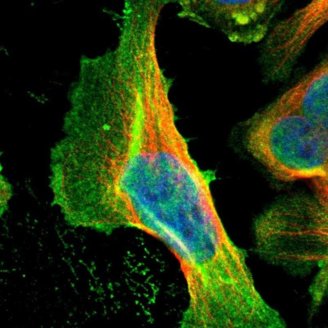 Cyclin T2 Antibody in Immunocytochemistry (ICC/IF)